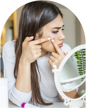 Active Acne at Everblooming Cosmetic & Laser Clinic in Pickering, ON
