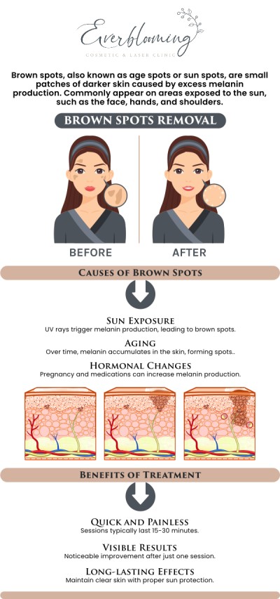 At Everblooming Cosmetic & Laser Clinic, Dr. Gihan El Mokadem and her professional team provide expert, physician-led solutions to target and eliminate brown spots, sun damage, and hyperpigmentation. We offer personalized treatment plans that prioritize your skin's health and safety while delivering visible, long-lasting results for a clearer and more youthful appearance. For more information, contact us today or schedule an appointment online. We are conveniently located at 1885 Glenanna Rd Unit # 110, Pickering, ON L1V 6R6. We serve clients from Pickering ON, Ajax ON, Scarborough ON, Green River ON, Whitby ON, and surrounding areas.