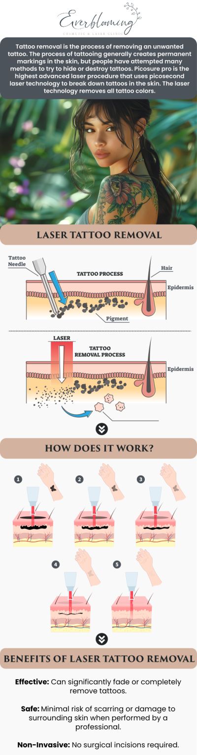 Say goodbye to unwanted ink with the most advanced tattoo removal technology available today. Our PicoSure Pro system uses ultra-short pulses of energy to shatter ink particles into tiny dust-like fragments, allowing your body to eliminate them naturally. Dr. Gihan El Mokadem and her professional team provide a safe, physician-led environment where even stubborn blue and green inks can be treated effectively with fewer sessions and greater comfort than older laser methods. For more information, contact us today or schedule an appointment online. We are conveniently located at 1885 Glenanna Rd Unit # 110, Pickering, ON L1V 6R6. We serve clients from Pickering ON, Ajax ON, Scarborough ON, Green River ON, Whitby ON, and surrounding areas.