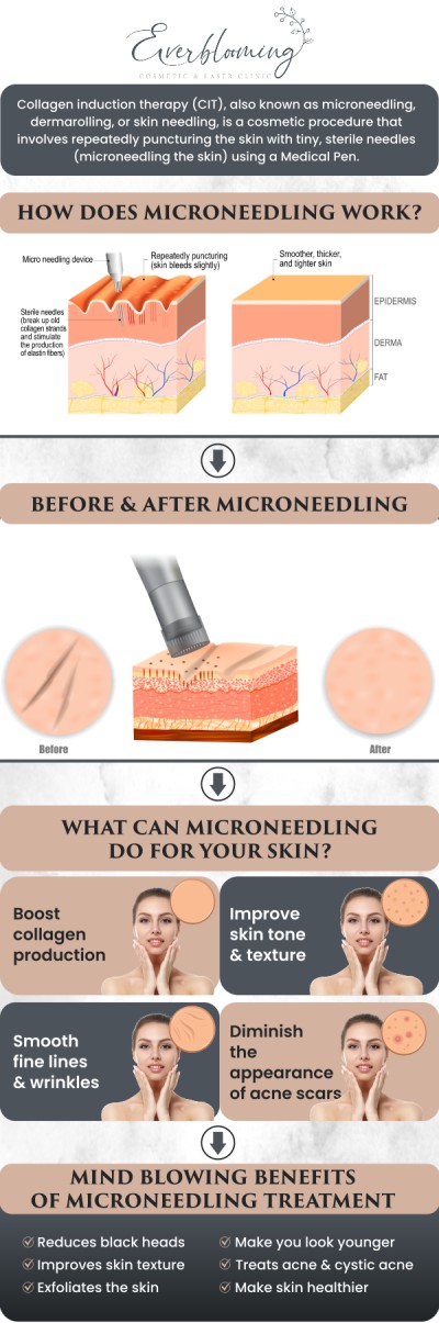 At Everblooming Cosmetic & Laser Clinic in Pickering, ON, Dr. Gihan El Mokadem and her team are proud to offer advanced microneedling treatments designed to stimulate collagen production and rejuvenate your skin from within. Whether you’re seeking to improve texture, reduce fine lines, or address acne scarring, our microneedling services are customized to your skin’s unique needs. For more information, contact us today or schedule an appointment online. We are conveniently located at 1885 Glenanna Rd Unit # 110, Pickering, ON L1V 6R6.