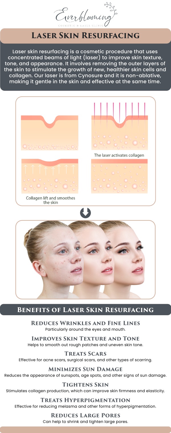 Transform your skin’s texture with advanced laser skin resurfacing at our Pickering facility. By removing damaged outer layers and stimulating new collagen growth, Dr. Gihan El Mokadem and her professional team help patients improve acne scars, sun damage, and deep-set wrinkles, revealing a fresh and healthy layer of skin beneath. For more information, contact us today or schedule an appointment online. We are conveniently located at 1885 Glenanna Rd Unit # 110, Pickering, ON L1V 6R6. We serve clients from Pickering ON, Ajax ON, Scarborough ON, Green River ON, Whitby ON, and surrounding areas.