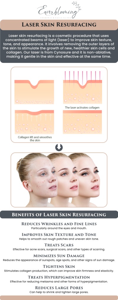 Transform your skin’s texture with advanced laser skin resurfacing at our Pickering facility. By removing damaged outer layers and stimulating new collagen growth, Dr. Gihan El Mokadem and her professional team help patients improve acne scars, sun damage, and deep-set wrinkles, revealing a fresh and healthy layer of skin beneath. For more information, contact us today or schedule an appointment online. We are conveniently located at 1885 Glenanna Rd Unit # 110, Pickering, ON L1V 6R6. We serve clients from Pickering ON, Ajax ON, Scarborough ON, Green River ON, Whitby ON, and surrounding areas.