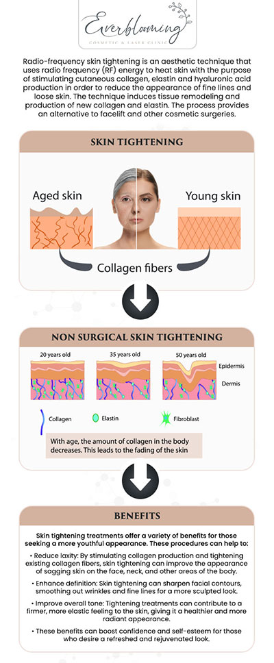 Restore your skin’s structural integrity and contour with our physician-led Radiofrequency (RF) skin tightening. This non-invasive treatment delivers controlled thermal energy into the deep layers of the dermis to contract existing collagen fibers and trigger the production of new ones. Dr. Gihan El Mokadem uses this technology to subtly lift sagging skin on the face, neck, and body, providing a firmer and more defined appearance without the need for surgery. For more information, contact us today or schedule an appointment online. We are conveniently located at 1885 Glenanna Rd Unit # 110, Pickering, ON L1V 6R6. We serve clients from Pickering ON, Ajax ON, Scarborough ON, Green River ON, Whitby ON, and surrounding areas. Restore your skin’s structural integrity and contour with our physician-led Radiofrequency (RF) skin tightening. This non-invasive treatment delivers controlled thermal energy into the deep layers of the dermis to contract existing collagen fibers and trigger the production of new ones. Dr. Gihan El Mokadem and her professional team use this technology to subtly lift sagging skin on the face, neck, and body, providing a firmer and more defined appearance without the need for surgery. For more information, contact us today or schedule an appointment online. We are conveniently located at 1885 Glenanna Rd Unit # 110, Pickering, ON L1V 6R6. We serve clients from Pickering ON, Ajax ON, Scarborough ON, Green River ON, Whitby ON, and surrounding areas.