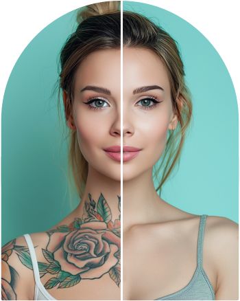 Unwanted Tattoo at Everblooming Cosmetic & Laser Clinic in Pickering, ON
