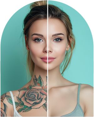 Unwanted Tattoo at Everblooming Cosmetic & Laser Clinic in Pickering, ON
