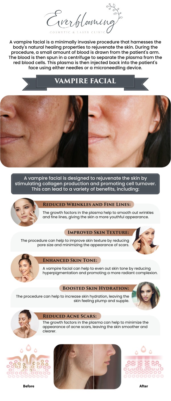 Say goodbye to dull skin and uneven tone. At Everblooming, our specialized Vampire Facial targets stubborn acne scars and signs of aging, using your own biological resources to reveal firmer, brighter, and healthier-looking skin. For more information, contact us today or schedule an appointment online. We are conveniently located at 1885 Glenanna Rd Unit # 110, Pickering, ON L1V 6R6. We serve clients from Pickering ON, Ajax ON, Scarborough ON, Green River ON, Whitby ON, and surrounding areas.