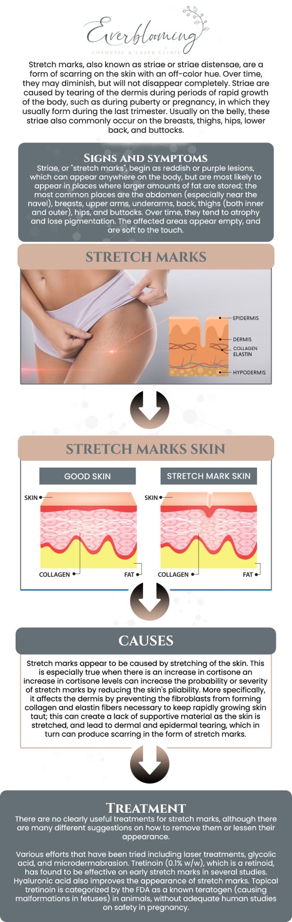 While stretch marks are a natural part of life, Dr. Gihan El Mokadem and her professional team offer innovative solutions to significantly improve their texture and color. Using a combination of microneedling and laser resurfacing, we stimulate deep collagen production to knit the skin back together and diminish the appearance of striae. For more information, contact us today or schedule an appointment online. We are conveniently located at 1885 Glenanna Rd Unit # 110, Pickering, ON L1V 6R6.